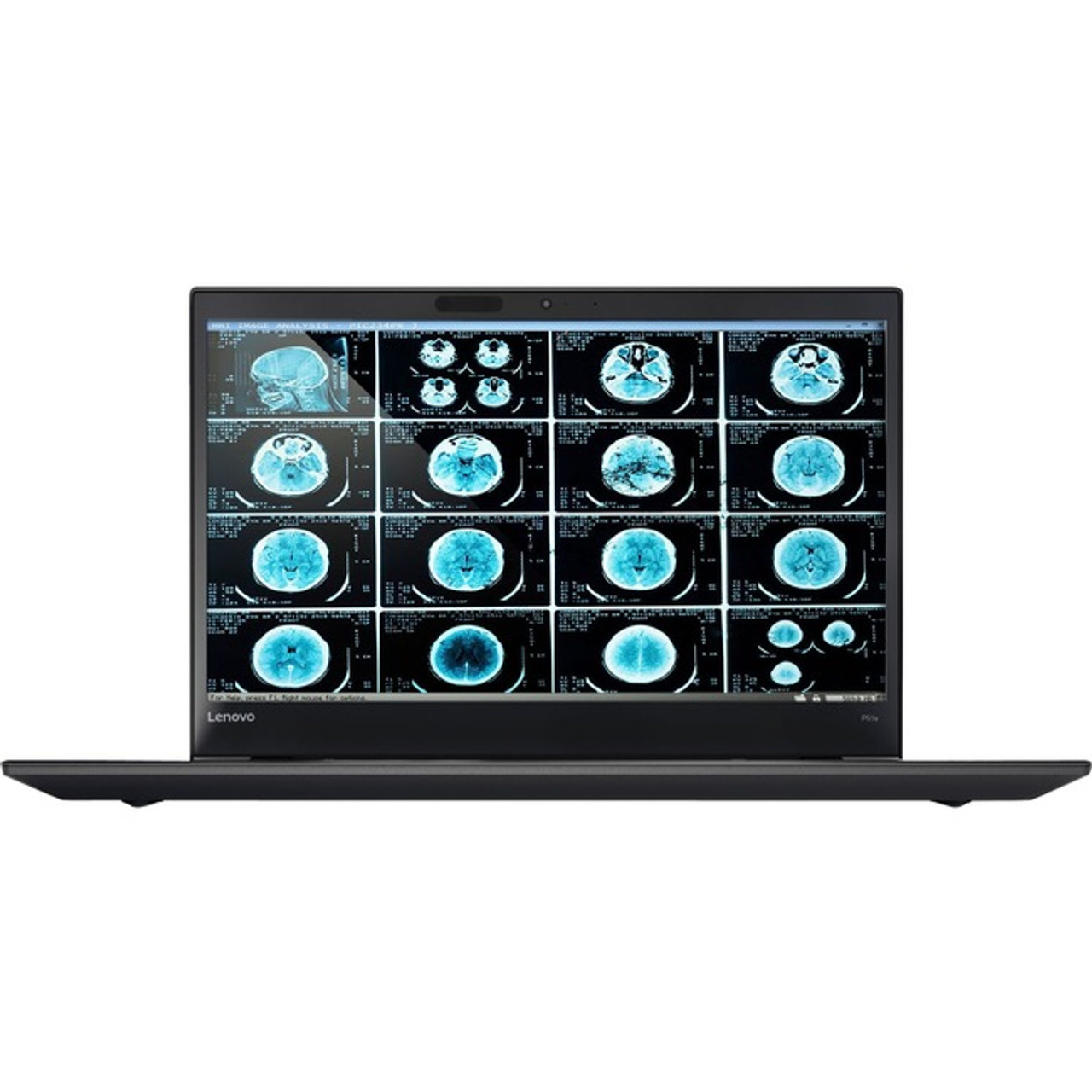 Lenovo 20HB001HUS