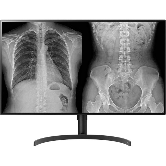 LG 32HL512D-B