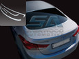 2011+ Elantra MD Chrome Rear Window Surround Set 4pc