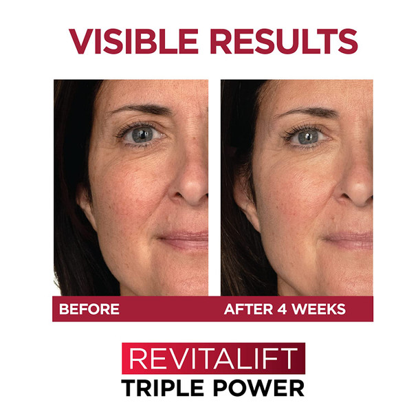 L'Oreal Paris Revitalift Triple Power Anti-Aging Cream Face Moisturizer 1.7 oz