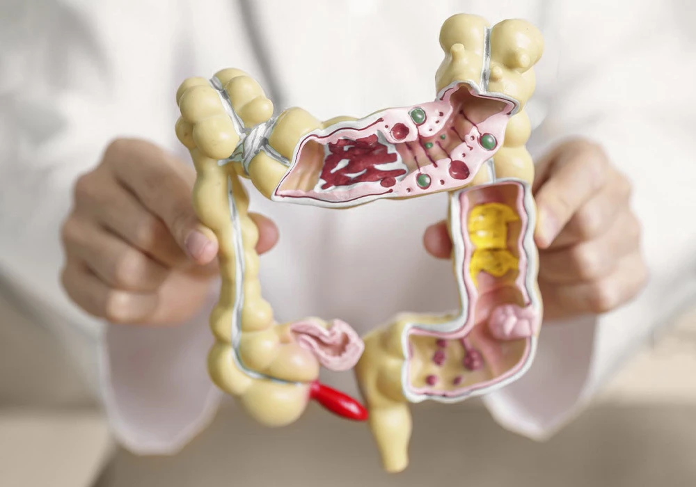 Detección precoz de cancer de colon en Farmacia de La Creu