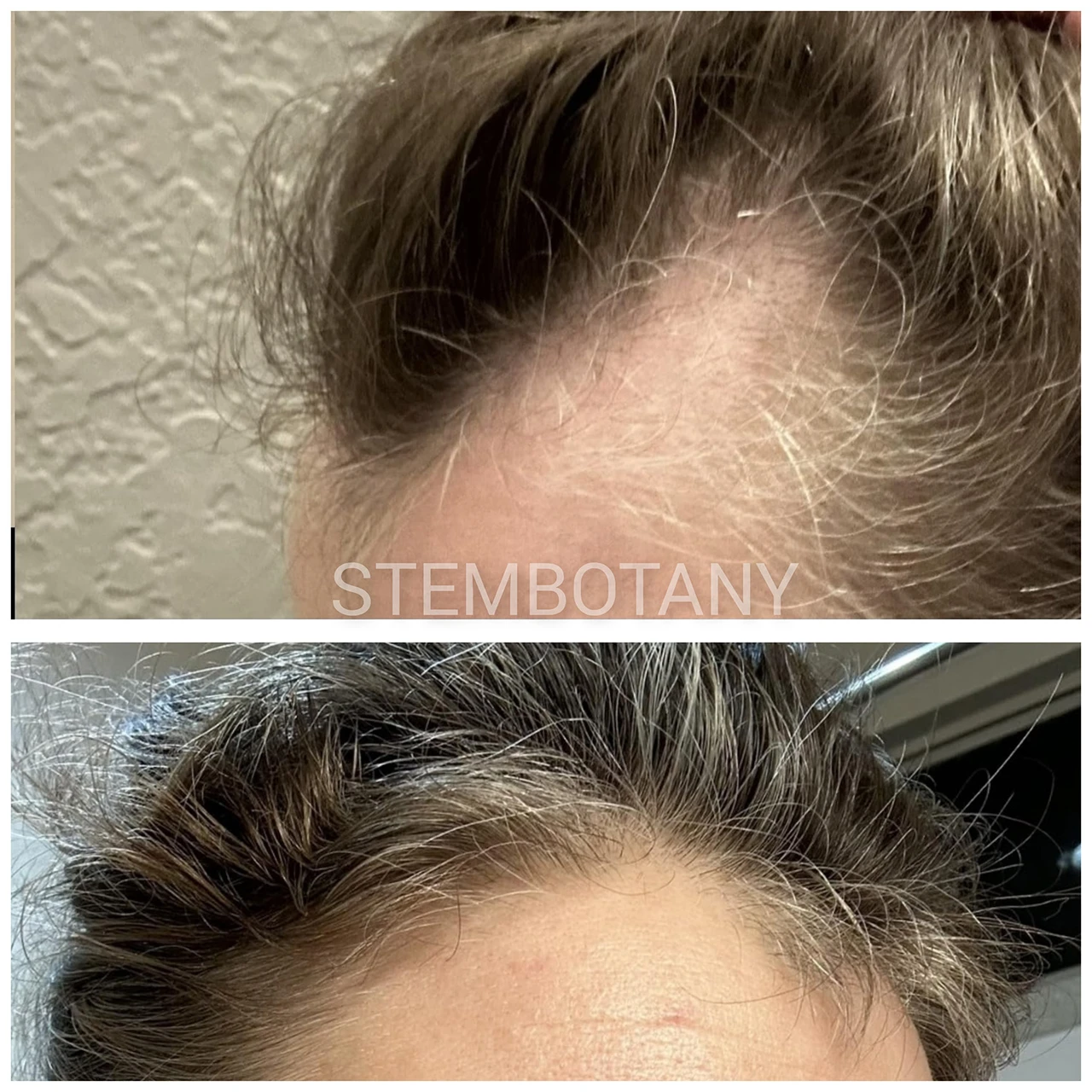 Stem Cell Scalp Serum | Copper Peptide hair Serum | Scalp Treatment Serum