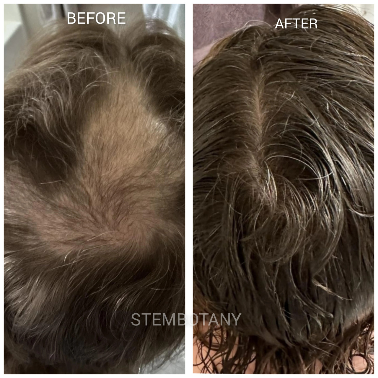 Absolute GHK-cu Stem Cells & Peptide Hair Growth Serum and Shampoo MTS Set