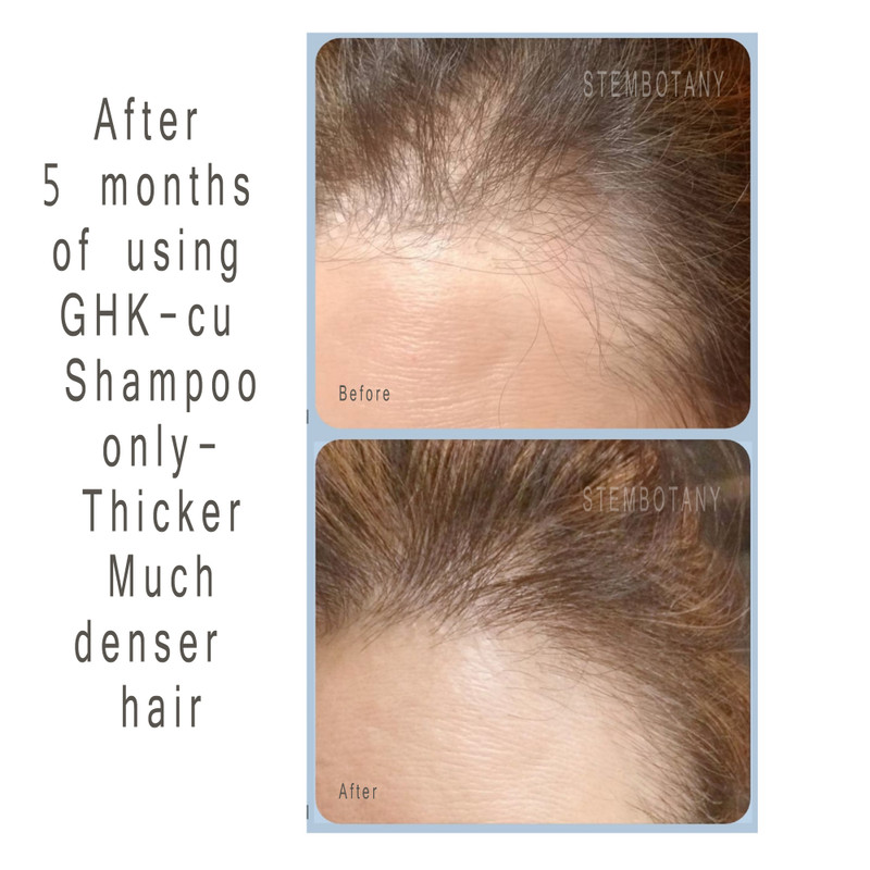 Alopecia Treatment | Copper Peptide Conditioner | Ghk-Cu Conditioner