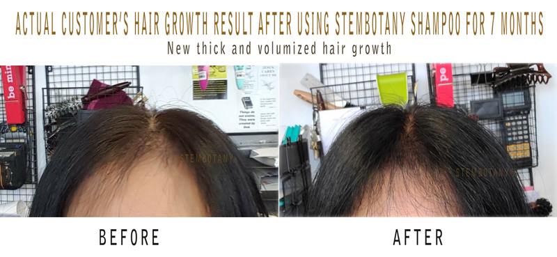 Hair loss treatment for men? Here is your answer to your hair loss problem or thinning hair.