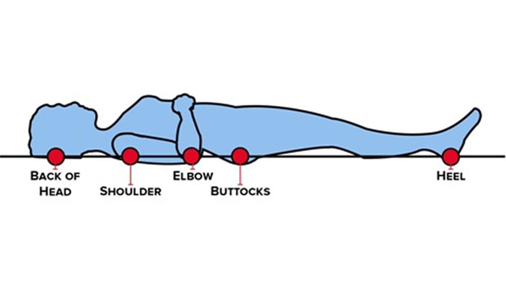 Pressure Points for Pressure sores