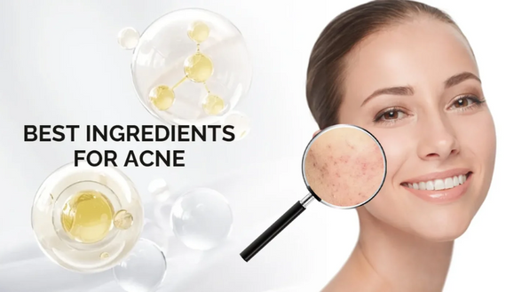 Top 5 Ingredients for Acne Repair and Skin Rejuvenation