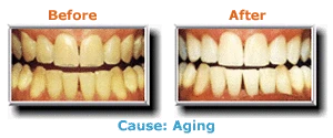 
                        Before and After
