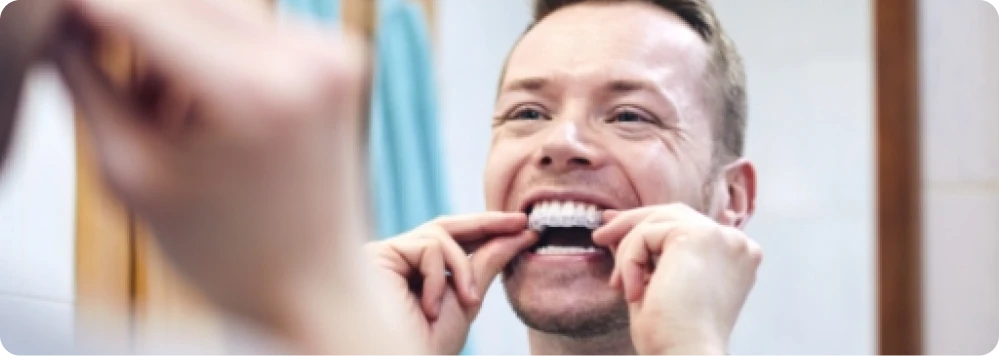 Man using teeth whitening trays