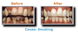 
                        Before and After