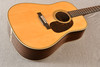 Martin Custom Shop HD 28 Style Adirondack Dreadnought #2724580 - Beauty 