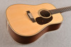 Martin Custom Shop HD12 28 Style 12 String Adirondack #2942906 - Beauty