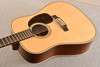 Martin Custom Shop HD12 28 Style 12 String Adirondack #2942906 - Top Angle