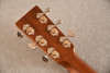 Martin Custom Shop 00-18 Burst (1 11/16 Nut) #3053198 — Ambertone - View 9