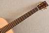 Martin Custom Shop 000-28 Modern Deluxe Adirondack C25-036520 — Acoustic Guitar - View 11
