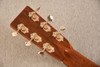 Martin Custom Shop OM-28 Adirondack Ambertone #3049376 — Acoustic Guitar - View 12