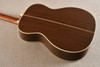 Martin Custom Shop OM-28 Adirondack Ambertone #3049376 — Acoustic Guitar - View 10