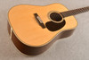 Martin Custom Shop HD-28 Adirondack #3049373 — Dreadnought Acoustic Guitar - View 4