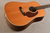 Martin HD-28 Player Grade (2000) #724513 - Beauty