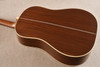 Martin Custom Shop HD-28 Adirondack (12-Fret) Ambertone #3090356 - View 7