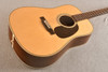Martin Custom Shop HD-28 Italian Alpine (2024)