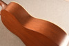 Martin 00L-17 Sunburst (2016) — Side