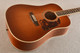 2025 Gallagher Doc Watson #4358 - Beauty