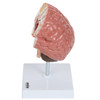 Axis Scientific Human Brain Anatomy Model with Pathologies