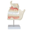 Axis Scientific Human Dental Development Anatomy Model