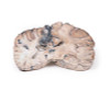 3D Printed Cerebral Arterio-Venous Malformation