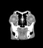 Dog Head Phantom for CT and X-Ray