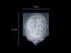 Adult Head X-Ray/CT and MRI Training Phantom Model