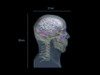Adult Head X-Ray/CT and MRI Training Phantom Model