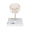 Atlas and Axis Bones Anatomy Model With Occipital Plate