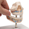 Milk Dentures Model