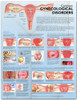 Common Gynecological Disorders Laminated Anatomical Chart