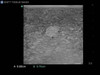 Elastography Ultrasound Breast Phantom