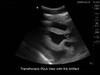 FAST Exam Real Time Ultrasound Training Model