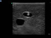 Gen II Ultrasound Central Line Training Model Replacement Tissue Insert