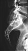 Full Body X-Ray Phantom With Real Human Skeleton Bones