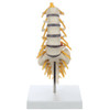 Rudiger Anatomie Premium Lumbar Spine with Herniated Disc