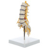Rudiger Anatomie Premium Lumbar Spine with Herniated Disc