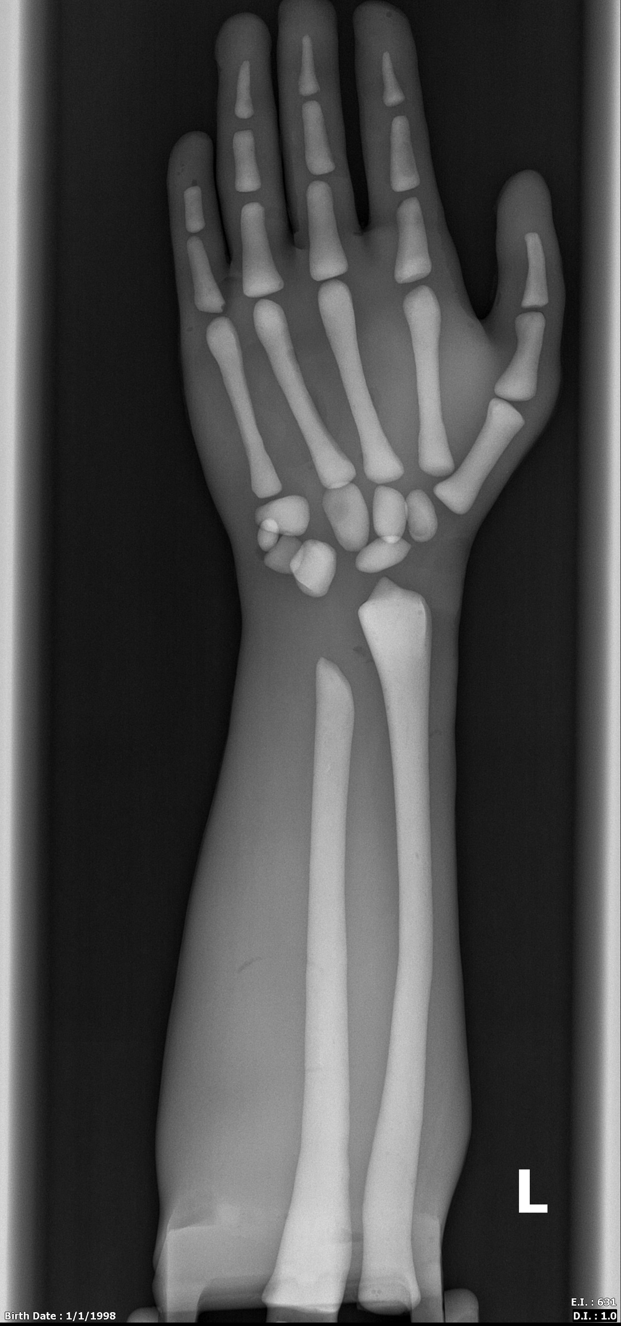 Adult Male Full Body XRay/CT and MRI Phantom Model