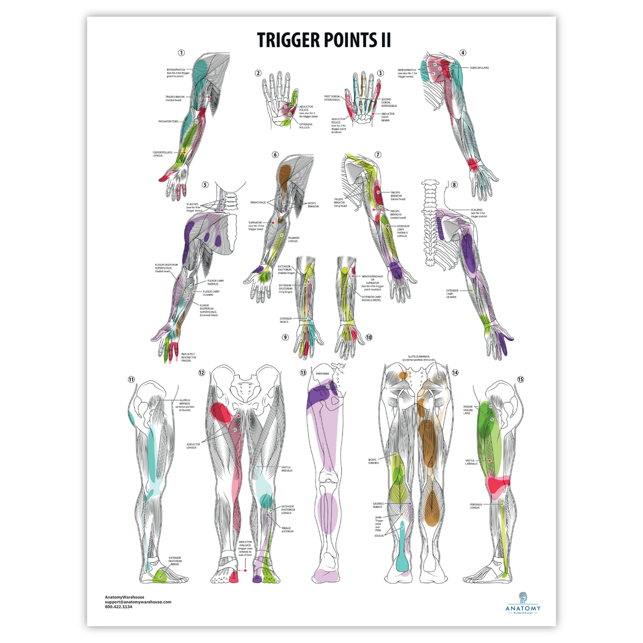 Trigger Point Player Anatomy Lab Trigger Points II Laminated Poster - Anatomy Warehouse