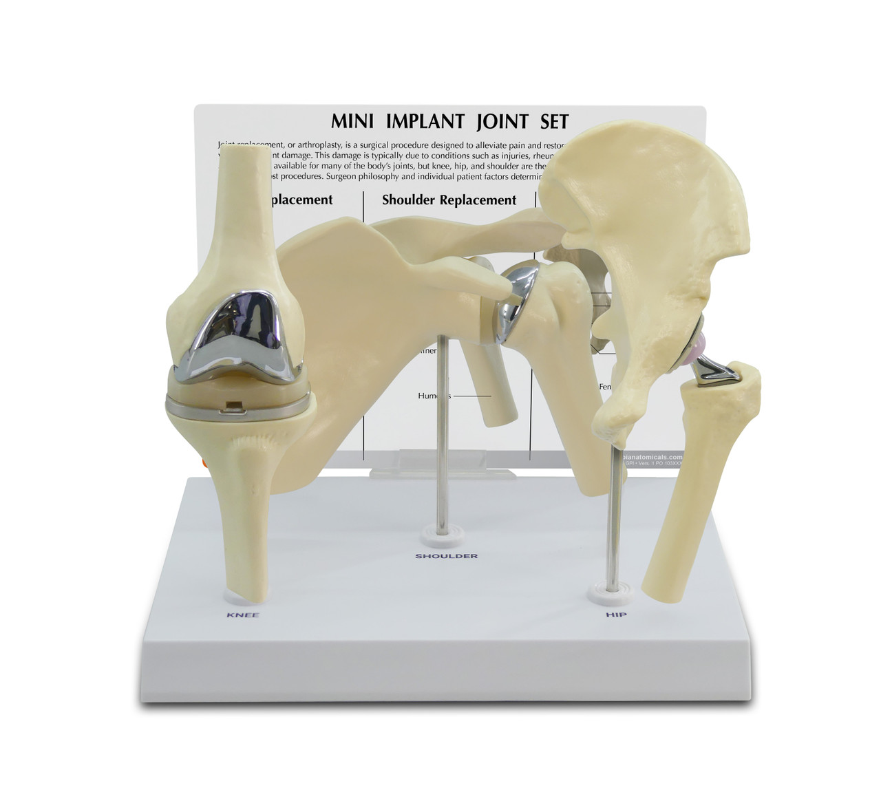 GPI Anatomicals - Mini Implant Joint Anatomy Model Set