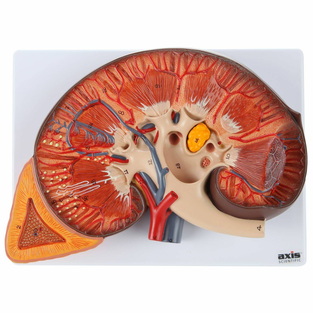 Axis Scientific Kidney with Adrenal Gland (3x Life-Size) | Anatomy