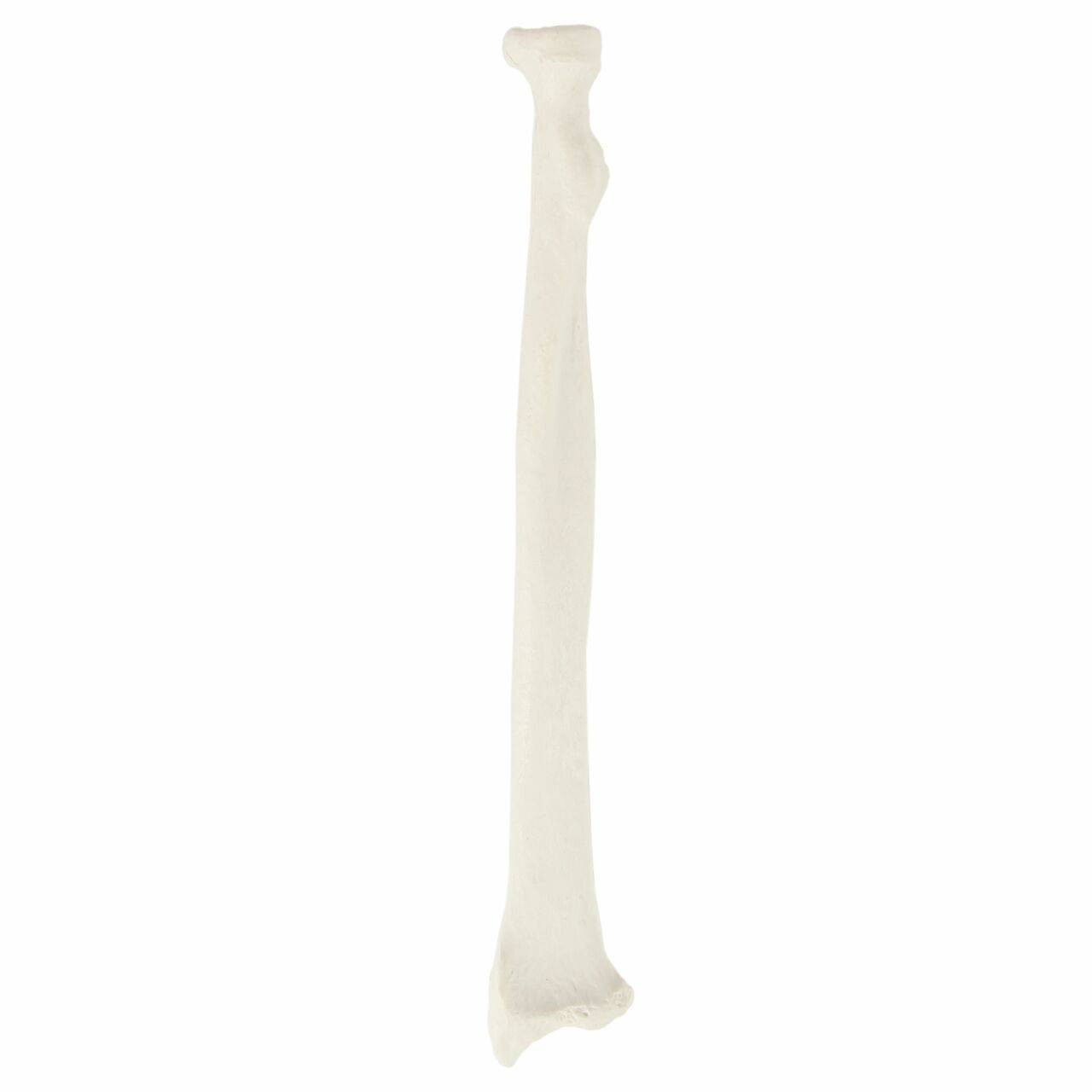 Axis Scientific Radius Bone