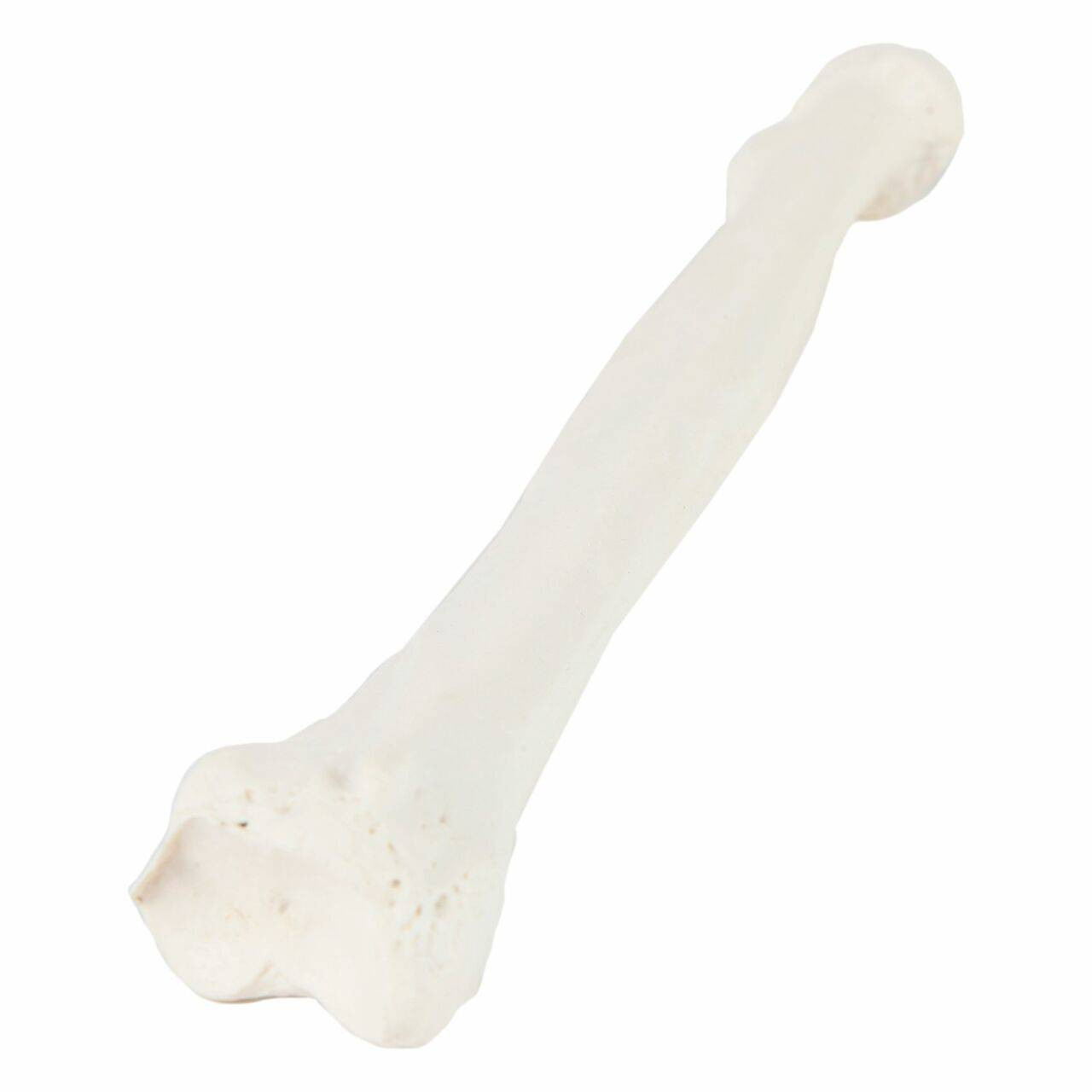 Axis Scientific Radius Bone