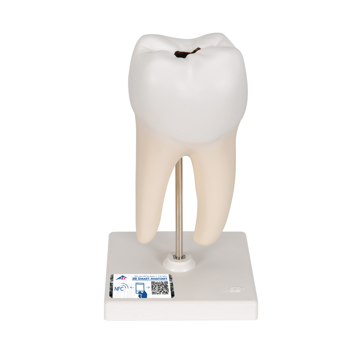 3B Scientific Lower Twin-Root Molar Anatomy Model 2 Parts