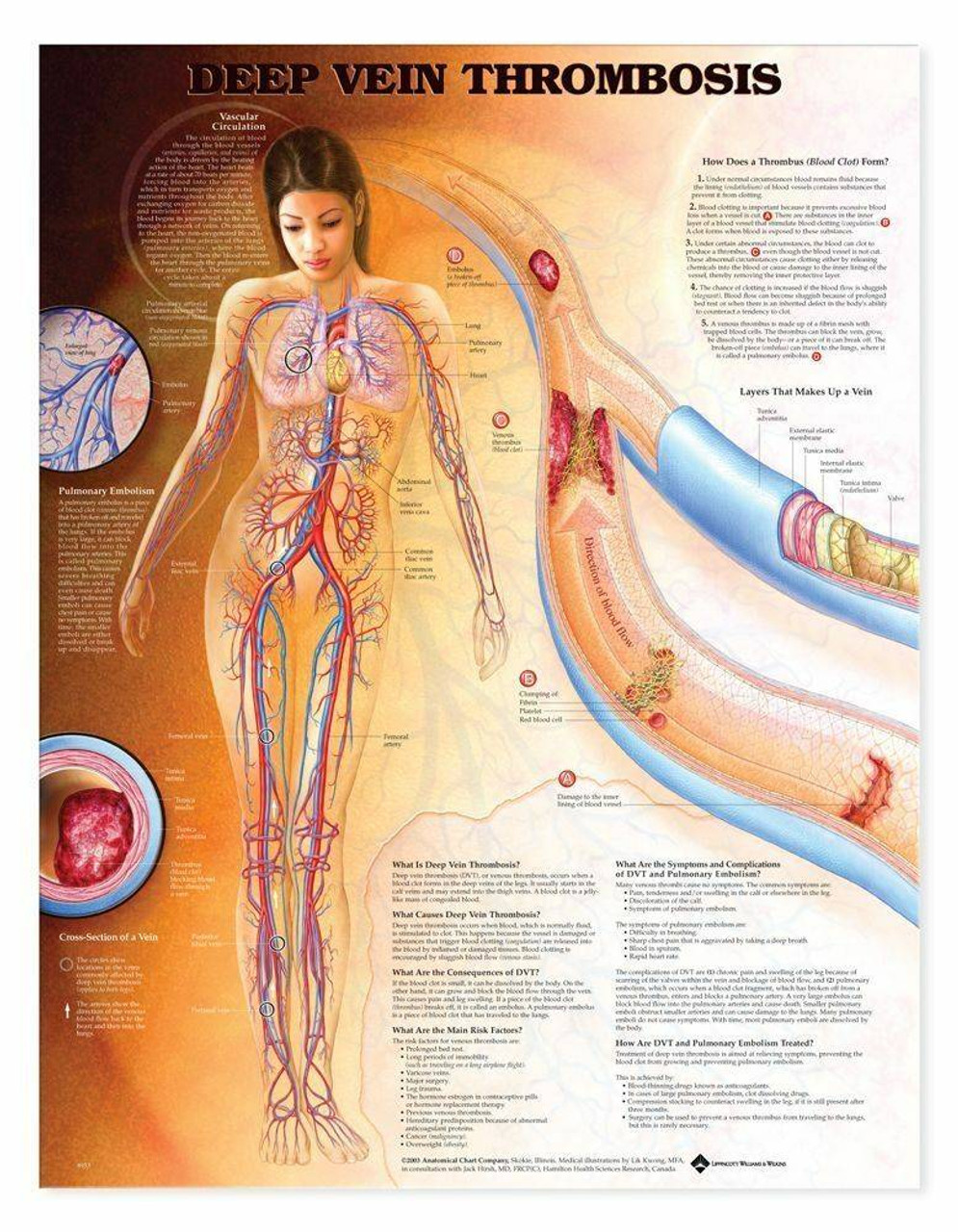 Anatomy Chart Deep Vein Thrombosis